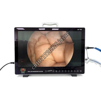 SY-PS050 Aukštos Kokybės Visiškai HD Medicinos Vaizdo kamerų Sistema Endoskopą Vienetas Histeroskopija Laparoscope Uroscope